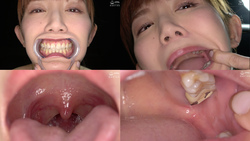 [Teeth and oral fetish] &quot;Beautiful woman&#39;s rare teeth, mouth and uvula with treatment marks!&quot; Miizumi Saki