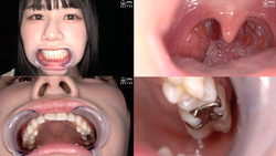 [Super cute beauty&#39;s super rare teeth, mouth, silver fillings, and uvula observation!] Ryo Tsukimi